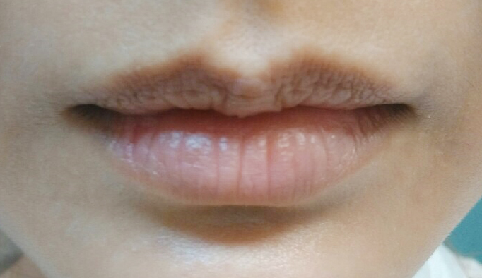 唇繡前與繡後